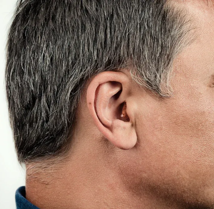 Detaljni prikaz kanalnog slušnog aparata u uhu starijeg muškarca