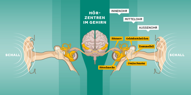 Infografik Knalltrauma Ohr